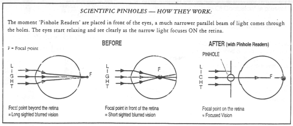 How pinhole glasses form an image on the retina.